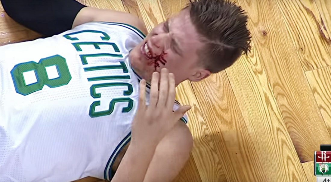 James Harden explose Jonas Jerebko